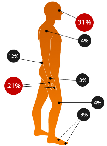 Welding Accidents Diagram