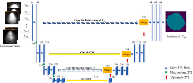 Fig4- The U-Net fusion ConvLSTM network structure developed in [4].