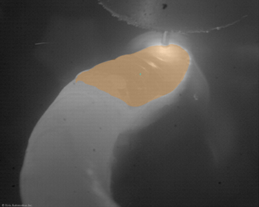 Welding Image of WAAM Quality Monitoring with the MeltPool AI image analysis tool with the correct melt pool geometry